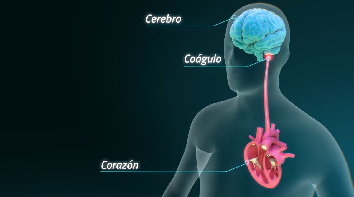 La coagulación sanguínea tiene solución